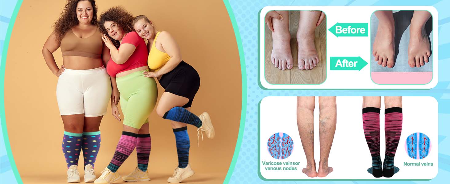Plus Size Compression Socks for Women
