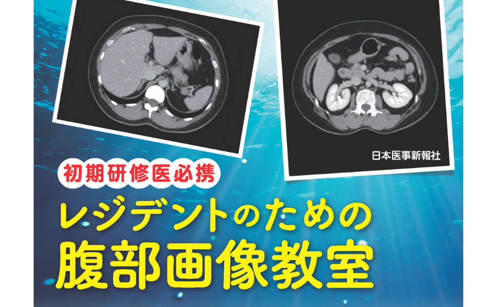 画像診断パワフルガイド 画像教室 放射線科CTレントゲンレジデント研修医内科 画像診断パワフルガイド 画像教室 放射線科CTレントゲン