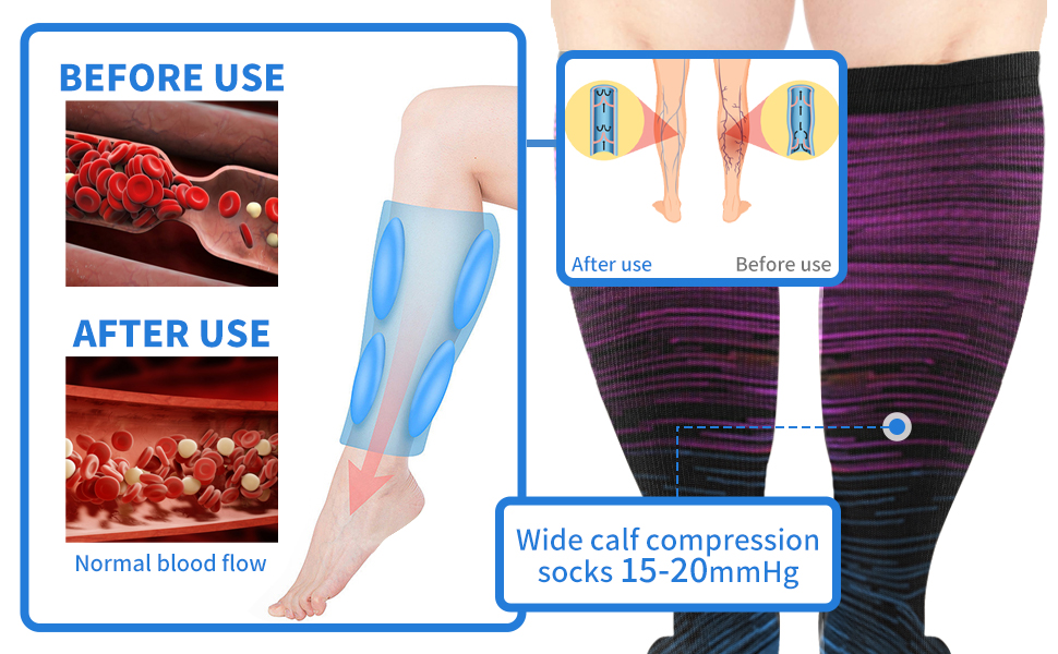 Compression Socks for Women Wide Calf