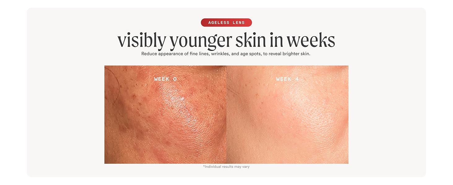 Visibly younger skin in weeks