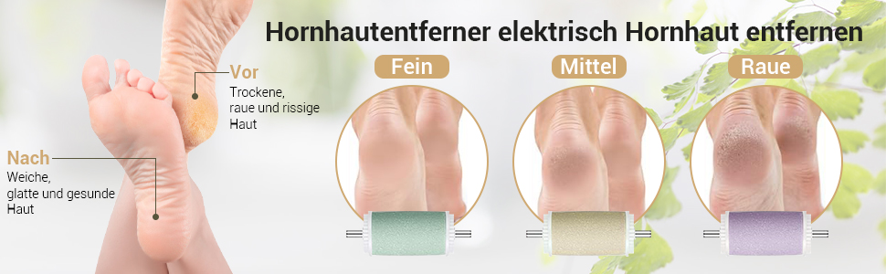 Elektrischer Hornhautentferner