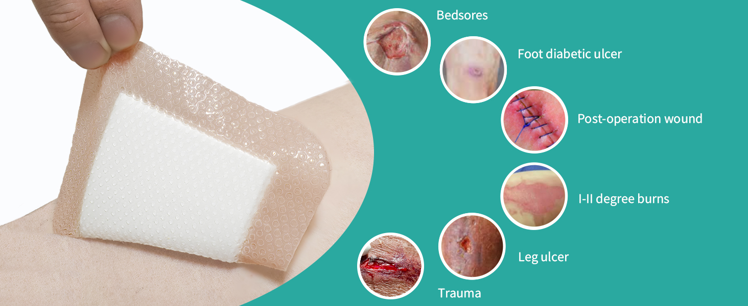 Ourmed Silicone Foam Dressing with Border Adhesive Large Ourmed Silicone Foam Dressing with Border Adhesive Large