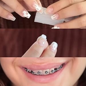 Orthodontic Relief Wax - Vitamin E, Aloe & Mint