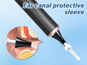 TopQuaFocus Electric Camera Earwax Removal Kit 1000P HD Otoscope