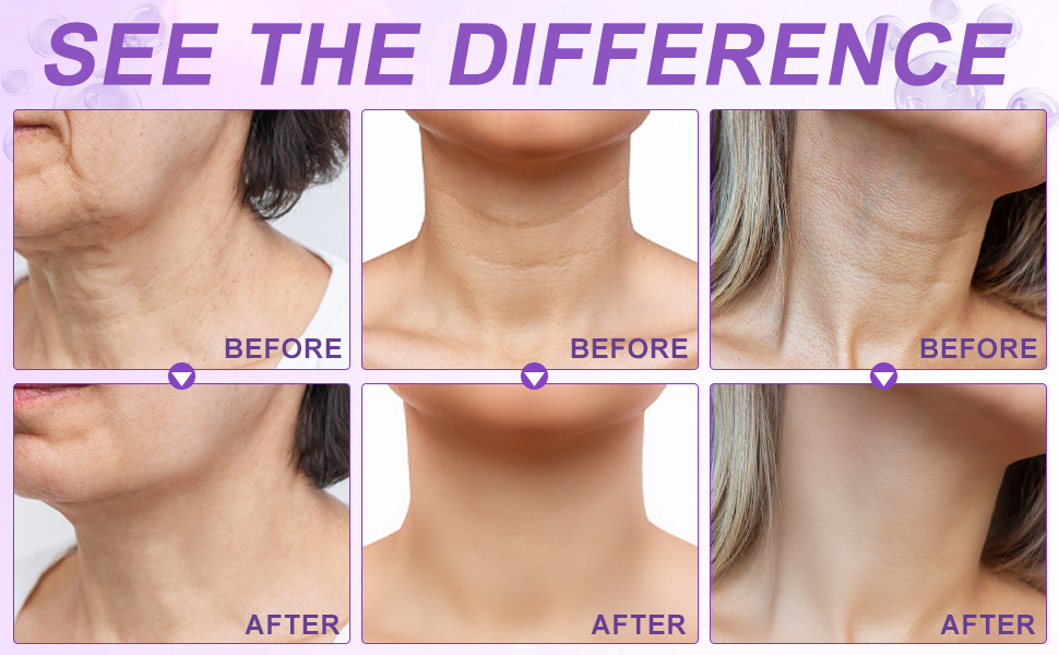 Ah8 Neck Creams for Tightening and Firming