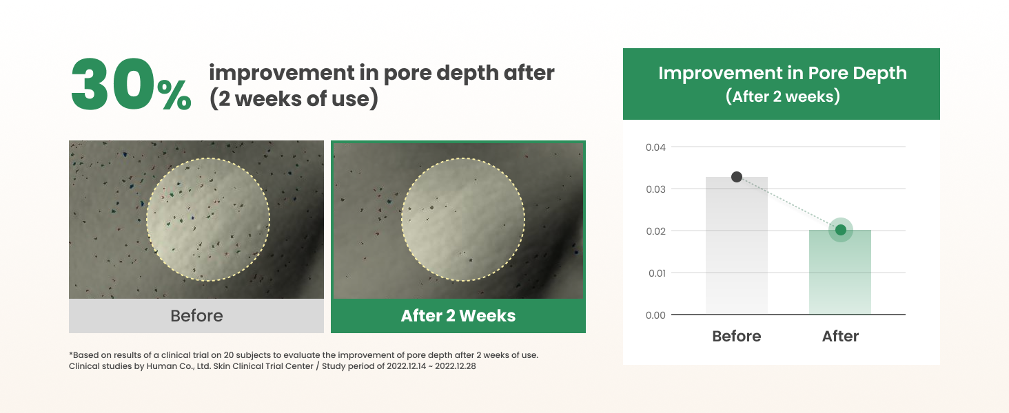 Test Results (Before & After) 