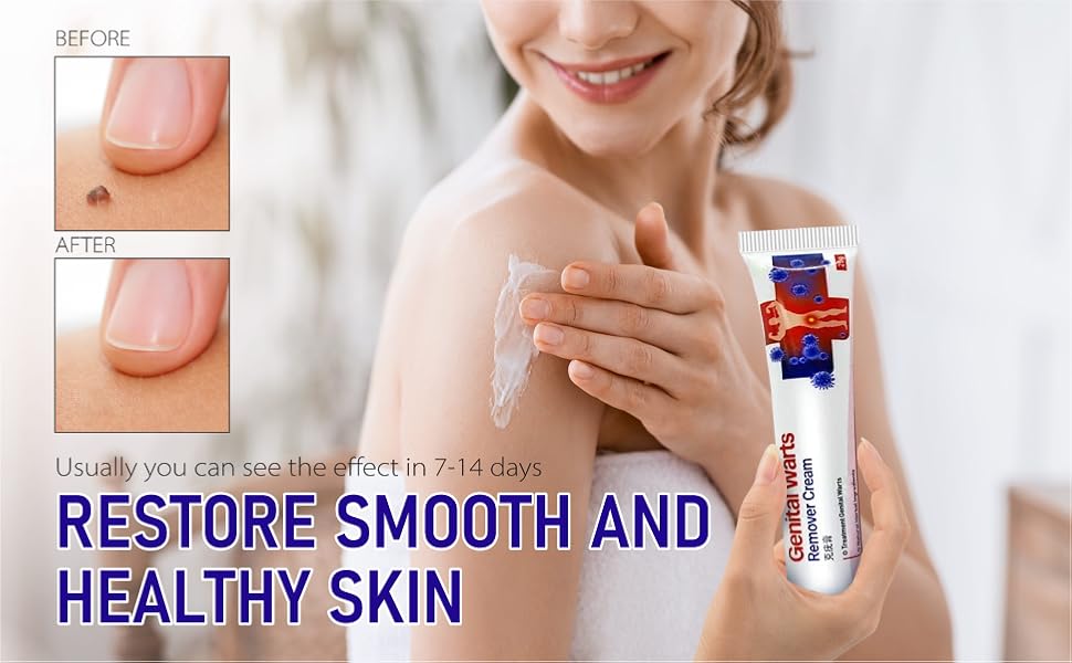 genital wart remover