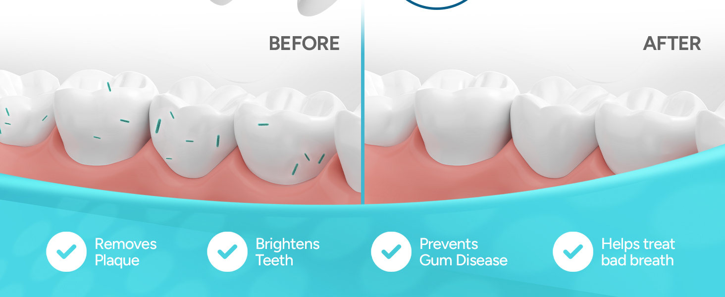 waterpik toothbrush heads