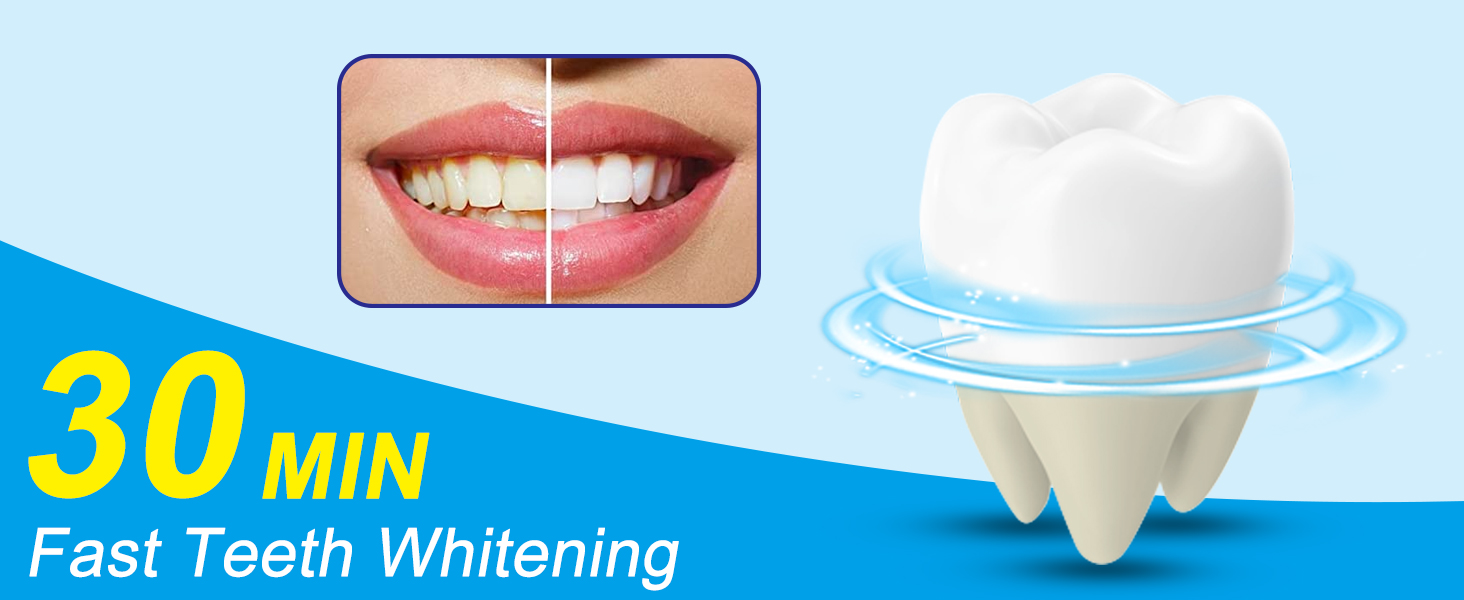 teeth whitening kit