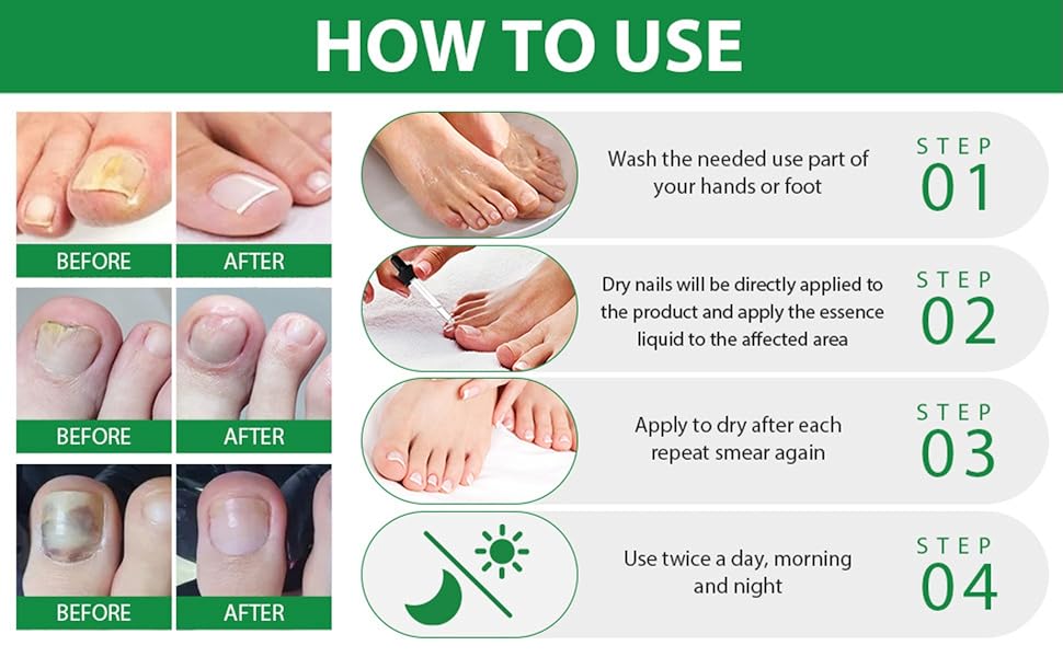 7 days nail treatment