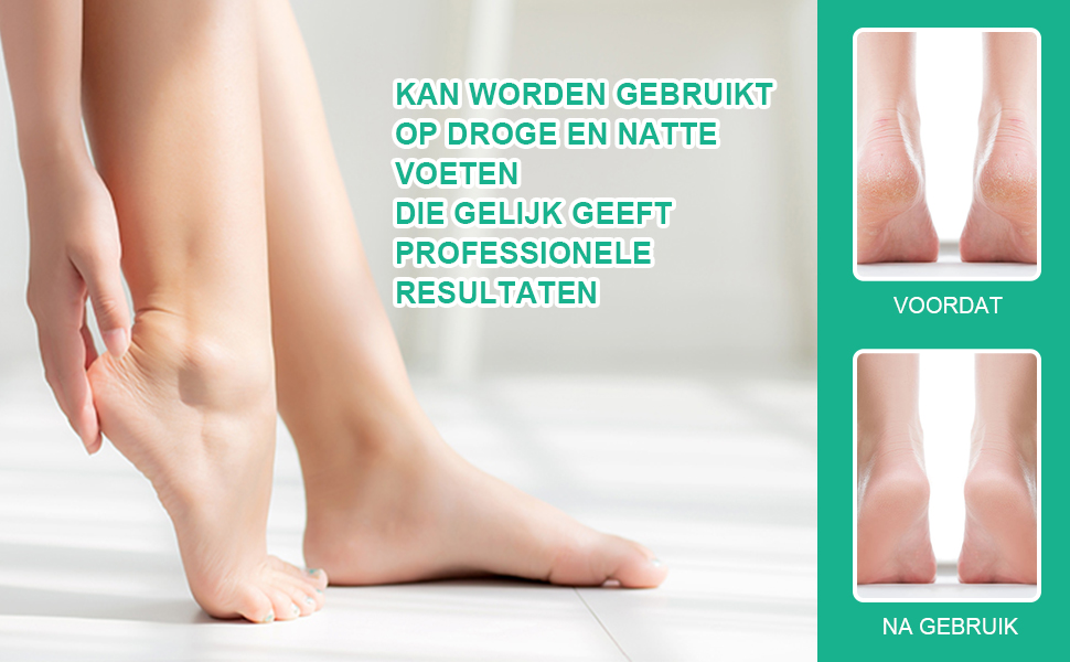 pedicure-eeltscheerapparaat