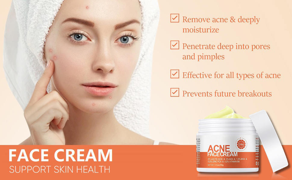 acne cream