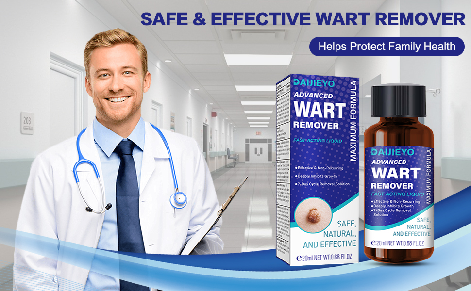 wart removerwart 