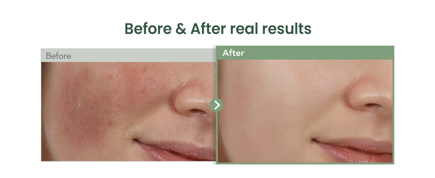 PLUM &amp; PANTHENOL Calming Ampoule