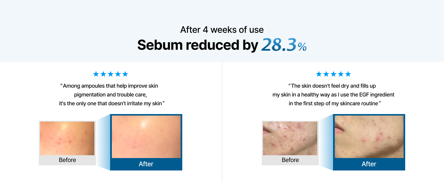 Sebum care, acne-prone skin, oily skin serum, pore care ampoule, before after sebum, EGF serum