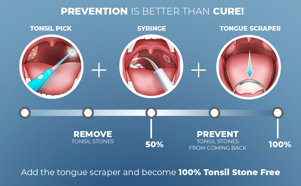 ORAVIX Tonsil Stone Remover Kit with 3 Spouts, Syringe and Tongue