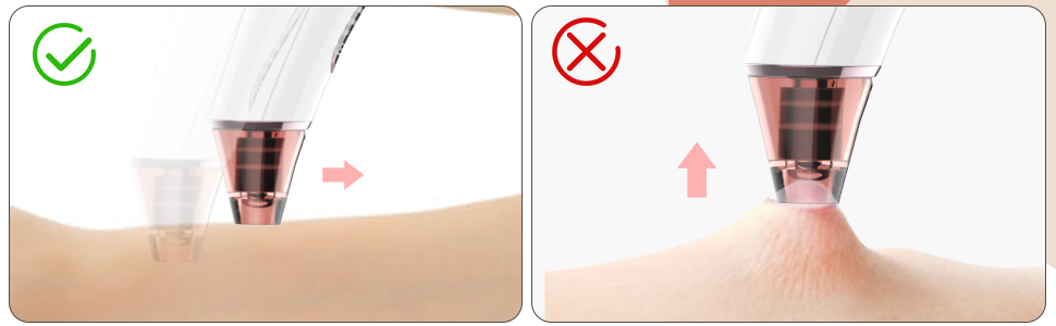 Blackhead Remover Pore Vacuum…