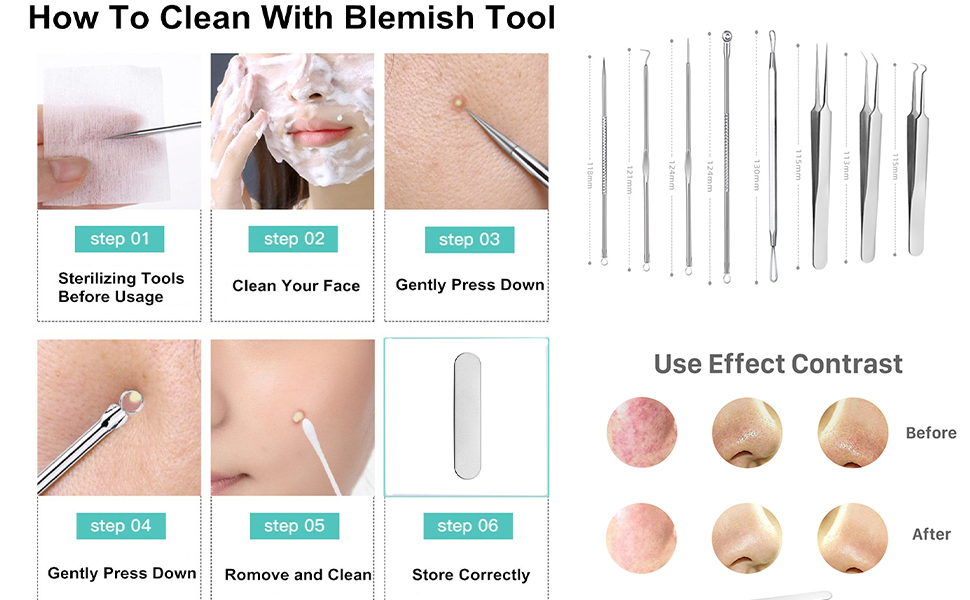 blackhead remover tools