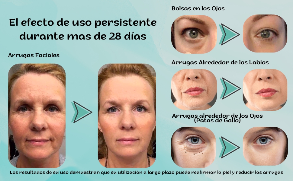 Elektrische gezichtsmassageapparaat Guasha Skincare Gezicht Reiniging Galvanisch