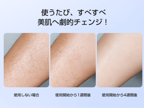 Amazon.co.jp: ENUOTEK 脱毛器 VIO対応 メンズ【サロン級IPL光