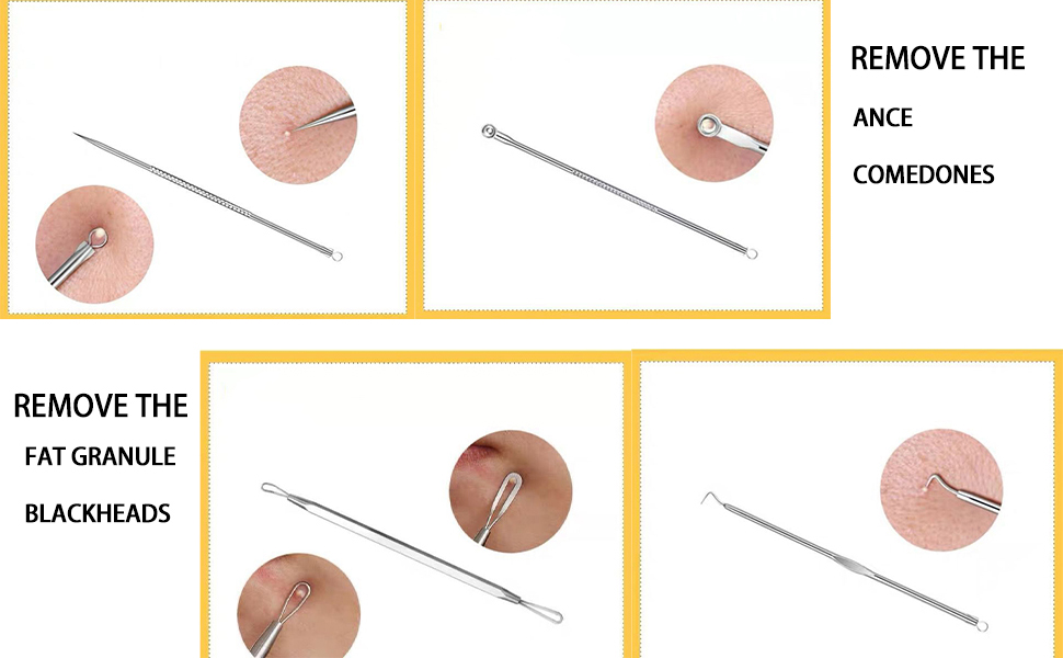 blackhead remover tools