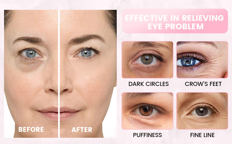 24 Pairs Eye Patches for Puffy Eyes and Dark Circles,Eye Masks for Dark Circles and Puffiness