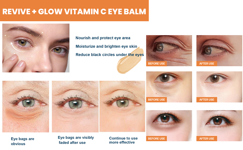 Revive + Glow Vitamin C Eye Balm, Moisturizing & Hydrating Eye Cream, Glow Eye Balm Stick