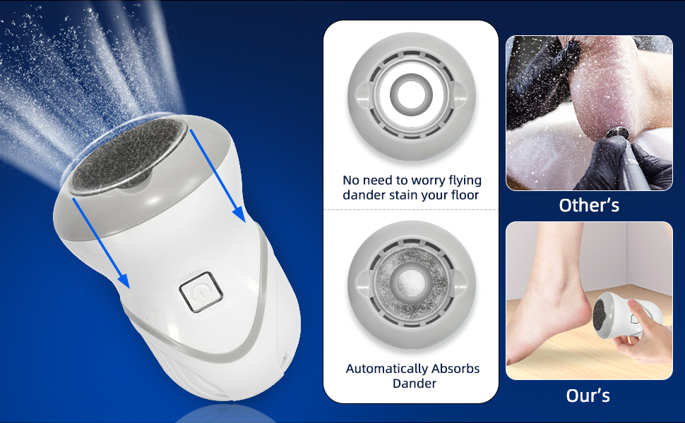 automatic  absorbs dander