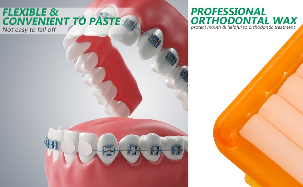 Healvian 12 Boxes Teeth Orthodontic Waxes Professional Dental Waxes for