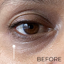 Fine Lines Before Using Peptide Eye Gel