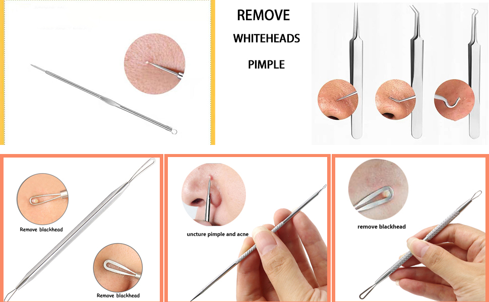 blackhead remover tools