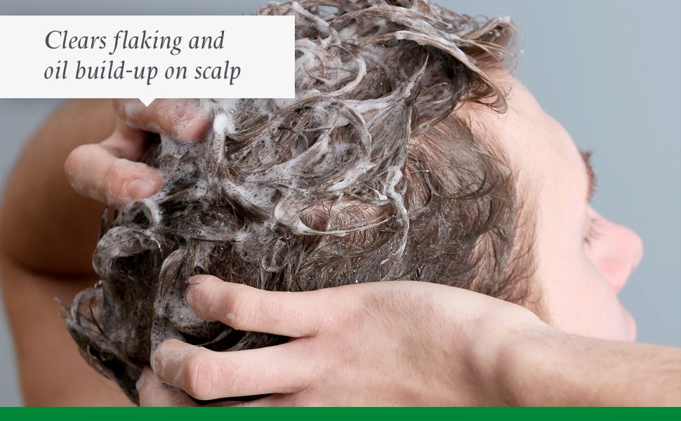 Philip Kingsley Flaky Scalp Shampoo for Flaky Dry, Oily