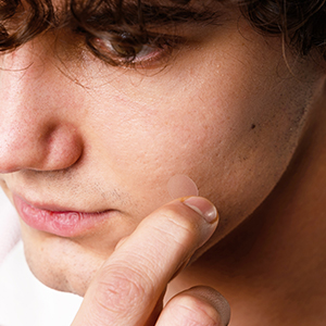 Panoxyl 日用隱形貼 | 皮膚科醫生推薦品牌 | 含水楊酸配方,有助管理瑕疵、疏通毛孔及溫和去角質 | 20片大尺寸貼片 + 20片小尺寸貼片 | 無乳膠配方 | 共40片 Panoxyl 日用隱形貼 | 皮膚科醫生推薦品牌 | 含水楊酸配方,有助管理瑕疵、疏通毛孔及溫和去角質 | 20片大尺寸貼片 + 20片小尺寸貼片 | 無乳膠配方 | 共40片