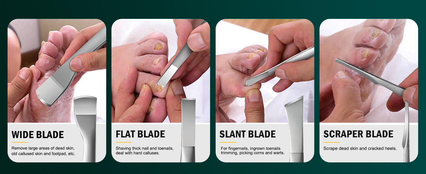 ingrown toenail tools