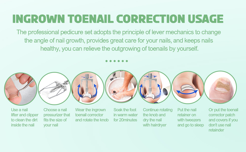 Ingrown Toenail Treatment Kit, Ingrown Toenail Removal Kit