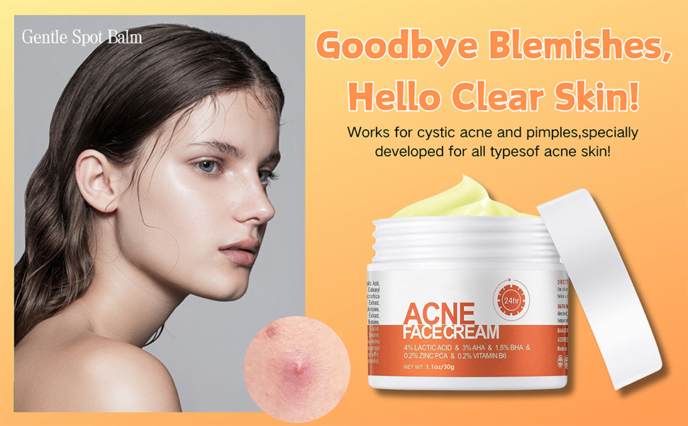 acne cream