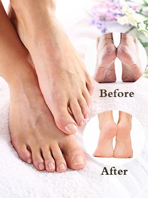 make your feet smooth
