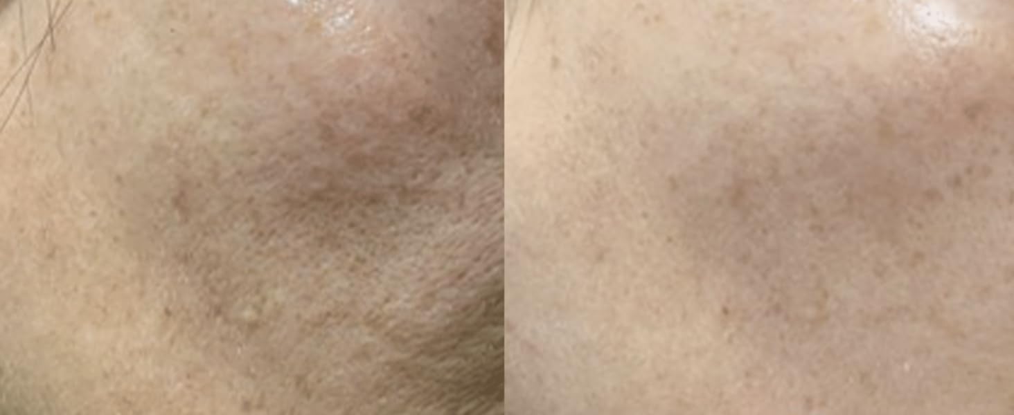 Blanc Power Ampoule 2.1