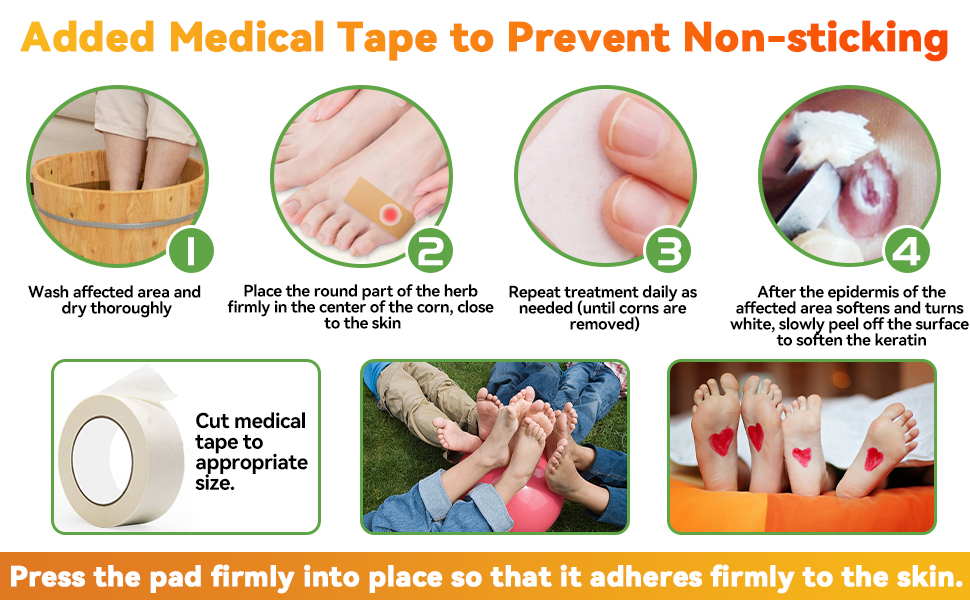 Wart Remover