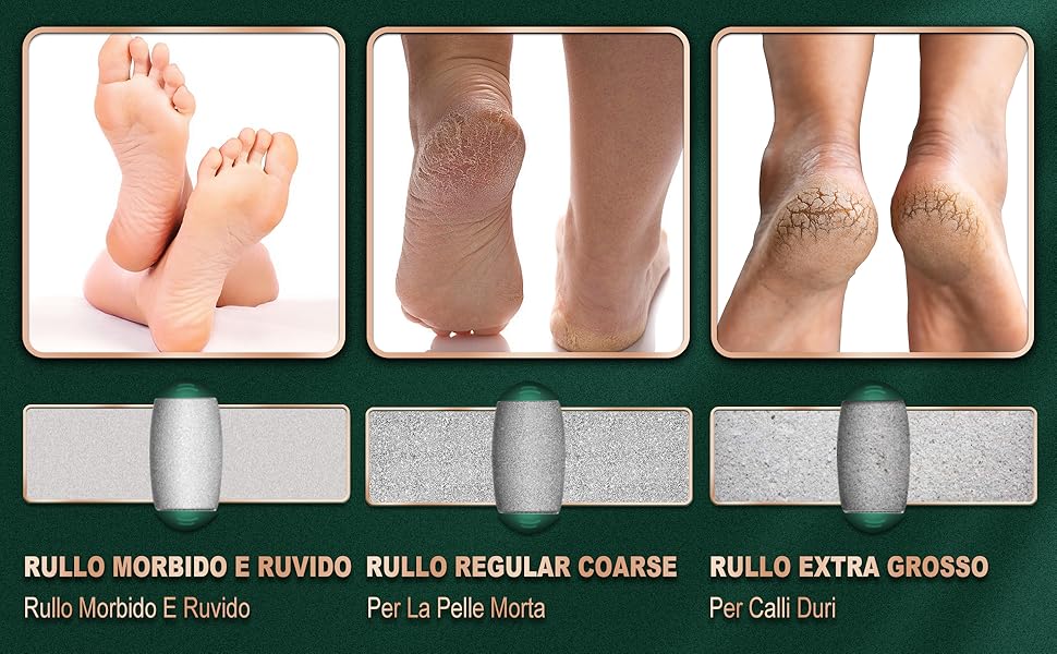 Foot Grinder