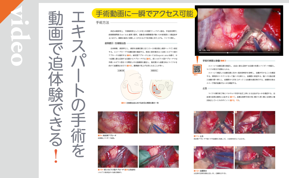 脳神経外科レジデントのためのベーシック手術 | 齋藤竜太 |本 | 通販