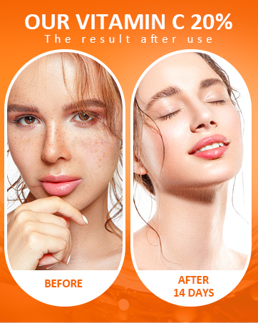 Amazon.com: Vitamin C Facial Serum 20%, Anti-Aging Vitamin C