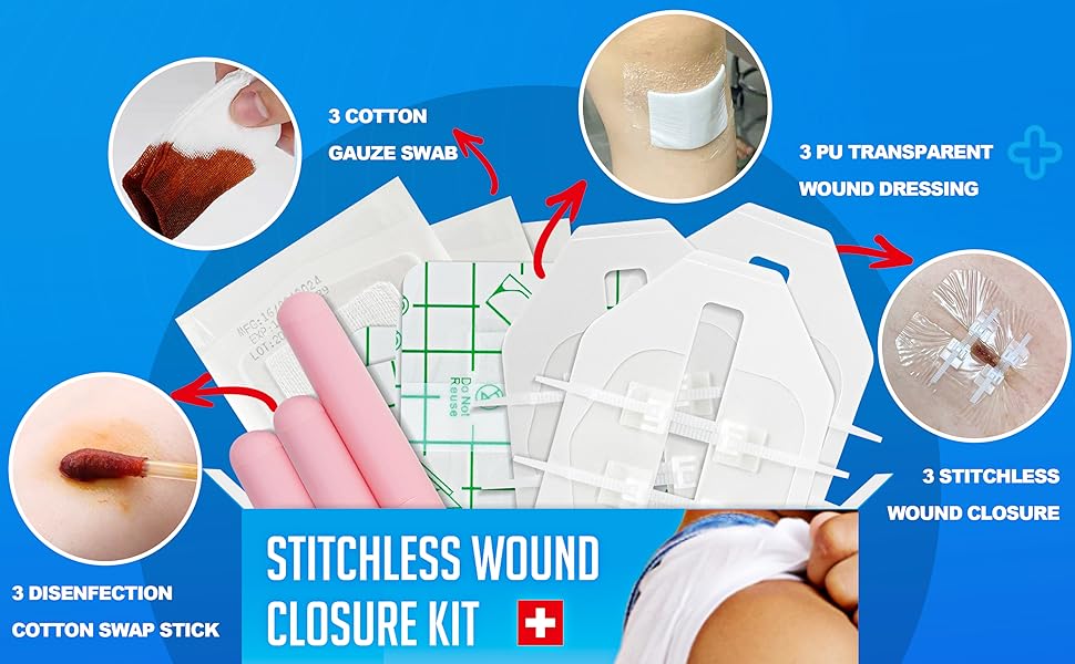 steri strips wound closure,zip stitch wound closure strips,Zipstitch Laceration Closure Kit for Cut