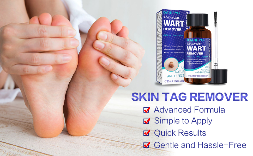 wart remover