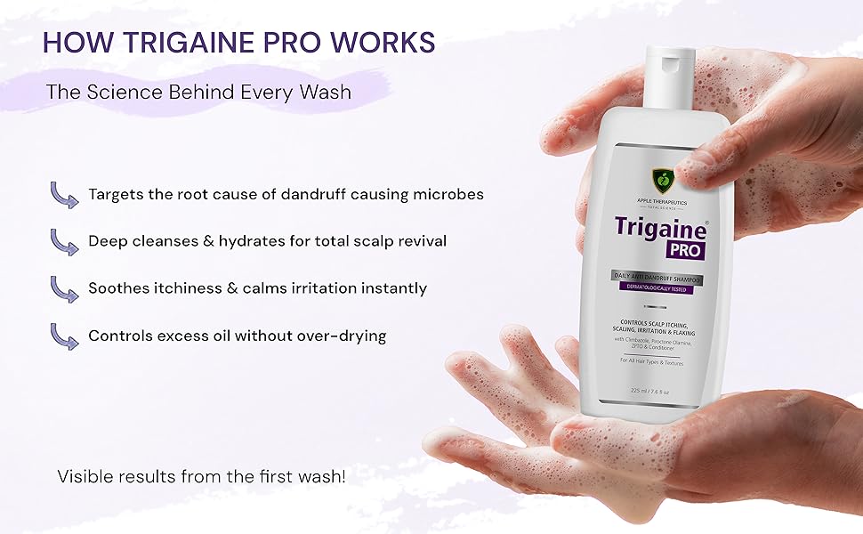trigaine pro anti dandruff shampoo slide 2
