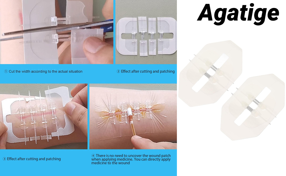 2PCS Zip Stitch Sutures, Butterfly Zipstitch Laceration Kit