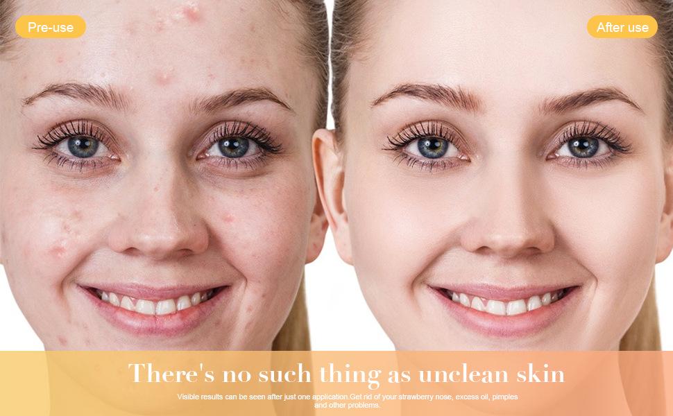 Compact Face Exfoliator for Travel