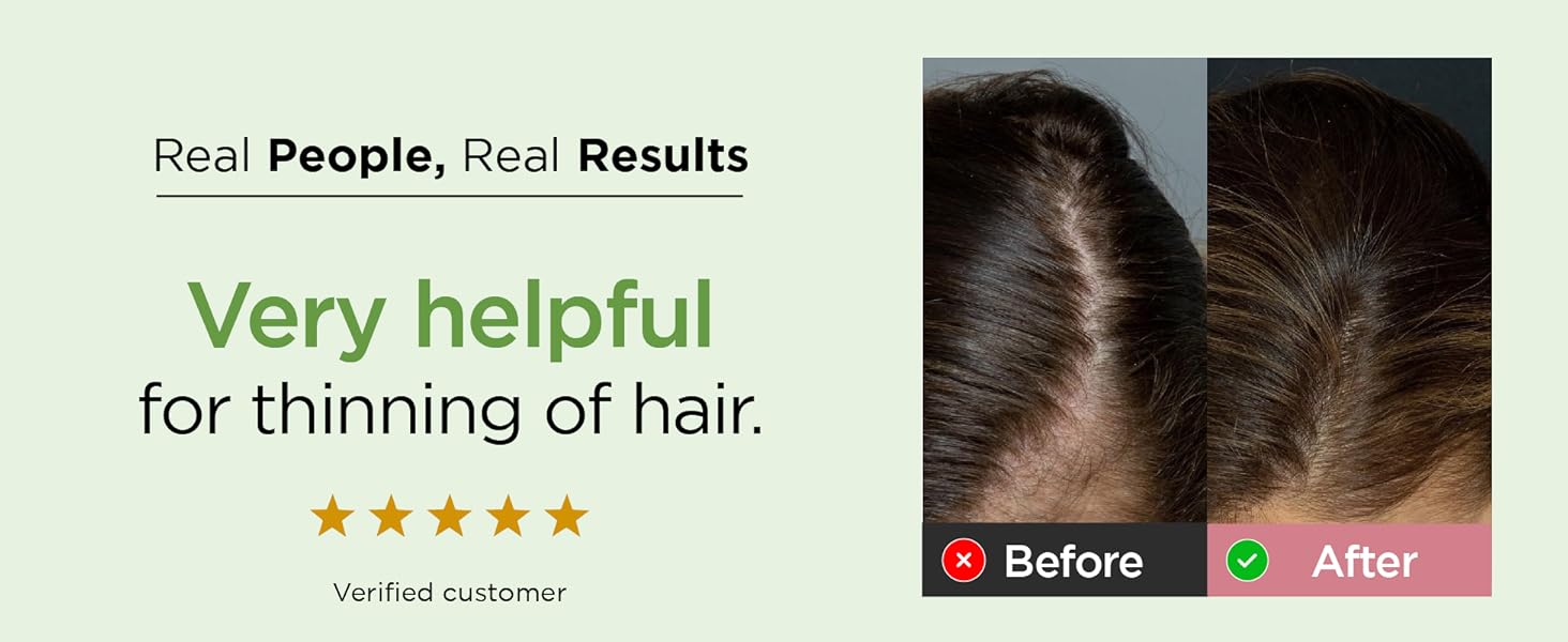 100% pure coldpressed castor hair oil for thicker hair eyebrows & eyelashes