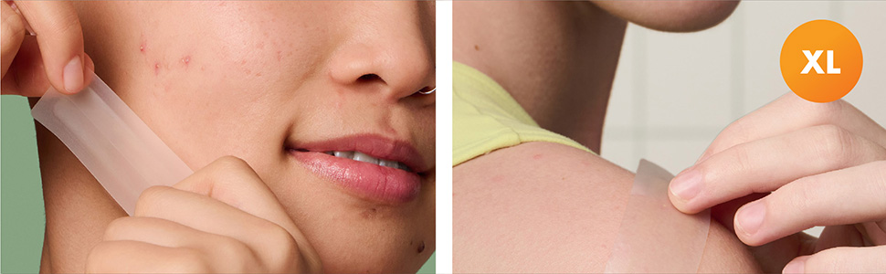 Hero, Hero Mighty Patch , Hero parches ,parches acné