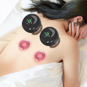 Intelligentes Schröpftherapie-Massagegerät